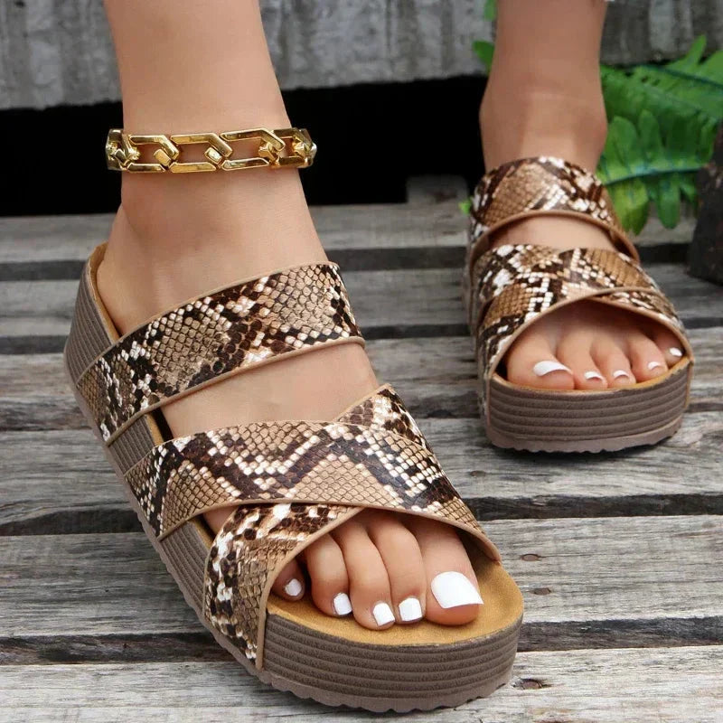 Orthopedic Summer Sandals for Women – Open Toe & Arch Support